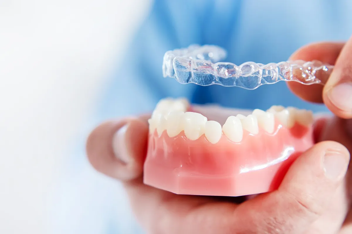 Invisalign Treatments: An Overview 