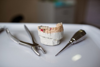 Implant Dentures