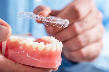 Invisalign for Overbite