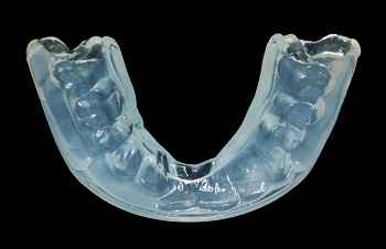 Invisalign