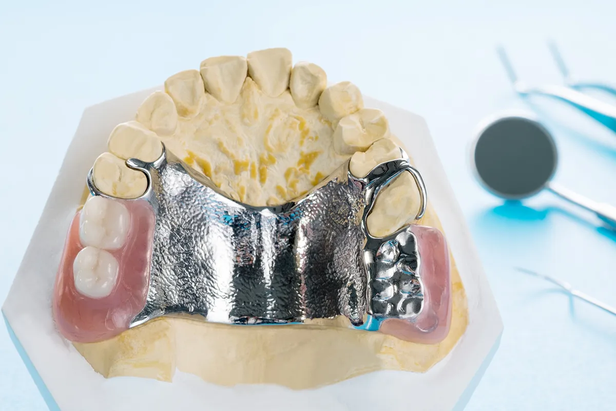 Implant Denture Aftercare & Maintenance Tips 